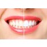 3-delni set VELLA za profesionalno izkušnjo ščetkanja zob vsebuje sonično zobno ščetko VELLA, potovalni etui in dodatni nadomestni nastavek v beli barvi. Sonična električna zobna ščetka VELLA je vaša nova pot do popolne ustne higiene. Sonično gibanje zobne ščetke ustvari mikromehurčke, ki pripomorejo do občutno boljšega čiščenja zob, na povsem neagresiven način. Inovativno pristrižene ščetine zobne ščetke so mehke in prepojene z aktivnim ogljem, ki ohranja naravno belino vaših zob. VELLA opravi kar 31.000 enakomernih gibov na minuto, ki jih je s klasično zobno ščetko nemogoče opraviti v tako kratkem času.  Redno odstranjevanje zobnih oblog je ključnega pomena pri pomoči k težavam, kot so: zobne obloge, vnetje dlesni ali zadah. Izbirajte med 3 načini čiščenja, ki so prilagojeni vašim potrebam: funkcija osnovnega čiščenja, funkcija nežnejše masaže vaših dlesni ali funkcija za poliranje vaših zob. Potovalni etui za sonično električno zobno ščetko VELLA omogoča optimalen način shranjevanja doma ali med potovanjem. Hkrati bo vaša zobna ščetka vedno skrbno v čistem okolju. Primeren je za vsakodnevno rabo, saj omogoča enostavno magnetno zapiranje, v vedno čistem okolju. Setu je priložen še 1 dodatni nadomestni nastavek/glava za zobno ščetko VELLA, ki zdrži cca. 3 mesece.
