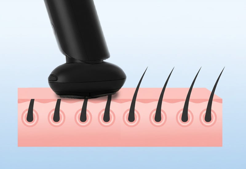 Natančno britje brez draženja kože